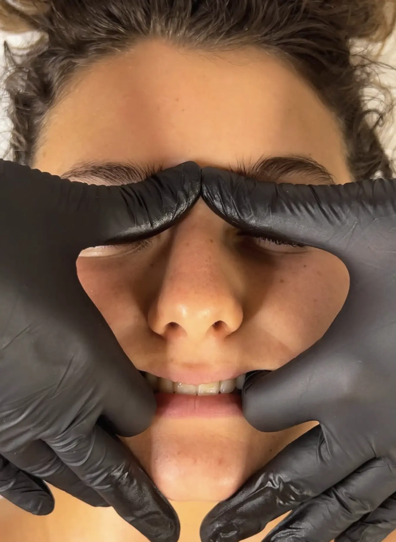 buccal fat massage
