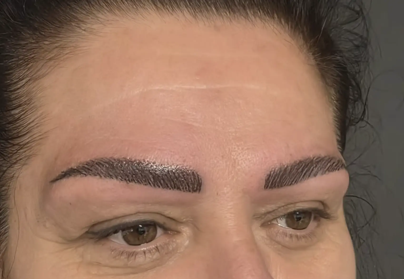 eyebrow tattoo removal perth