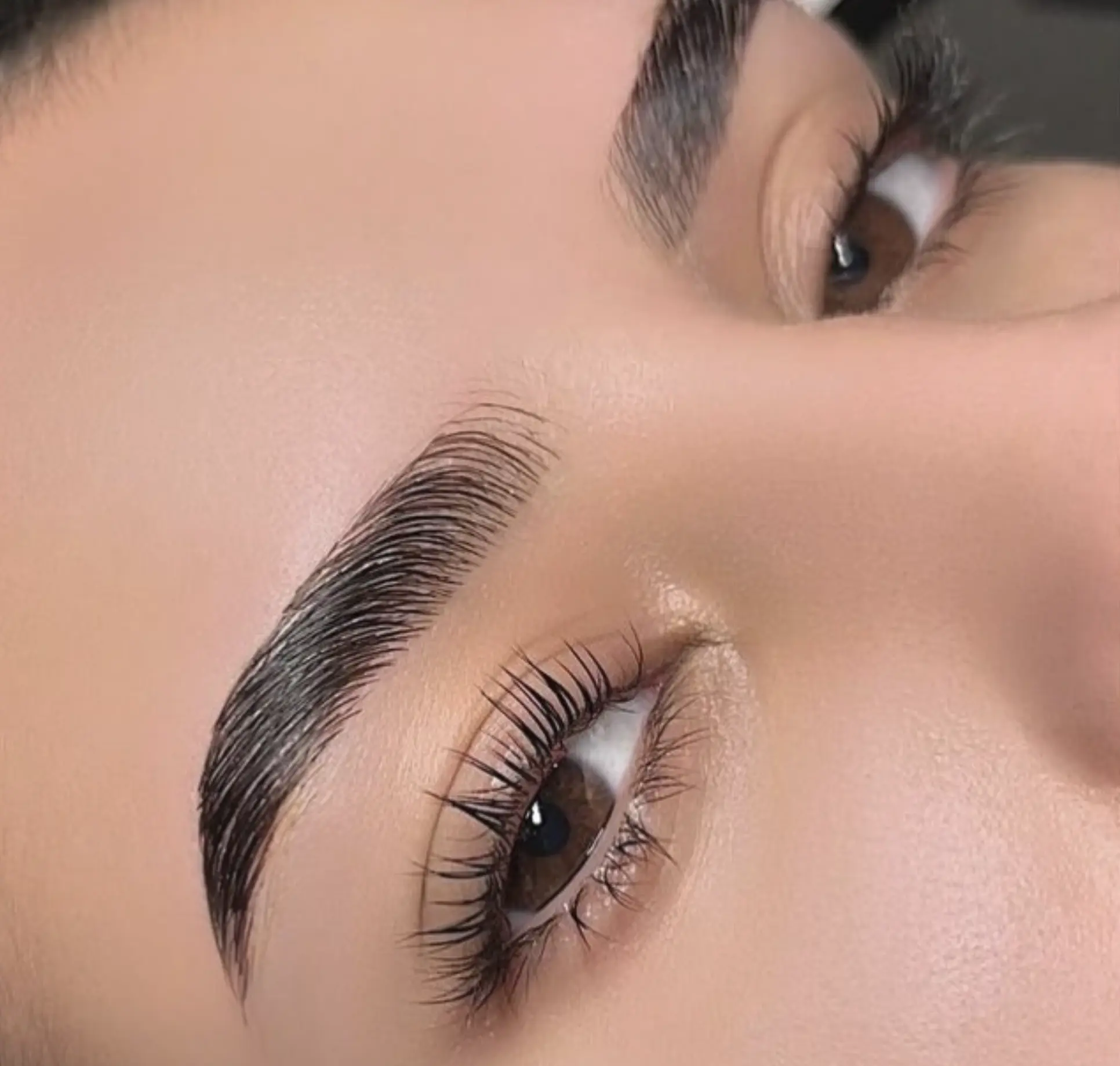 eyebrow tattoo removal