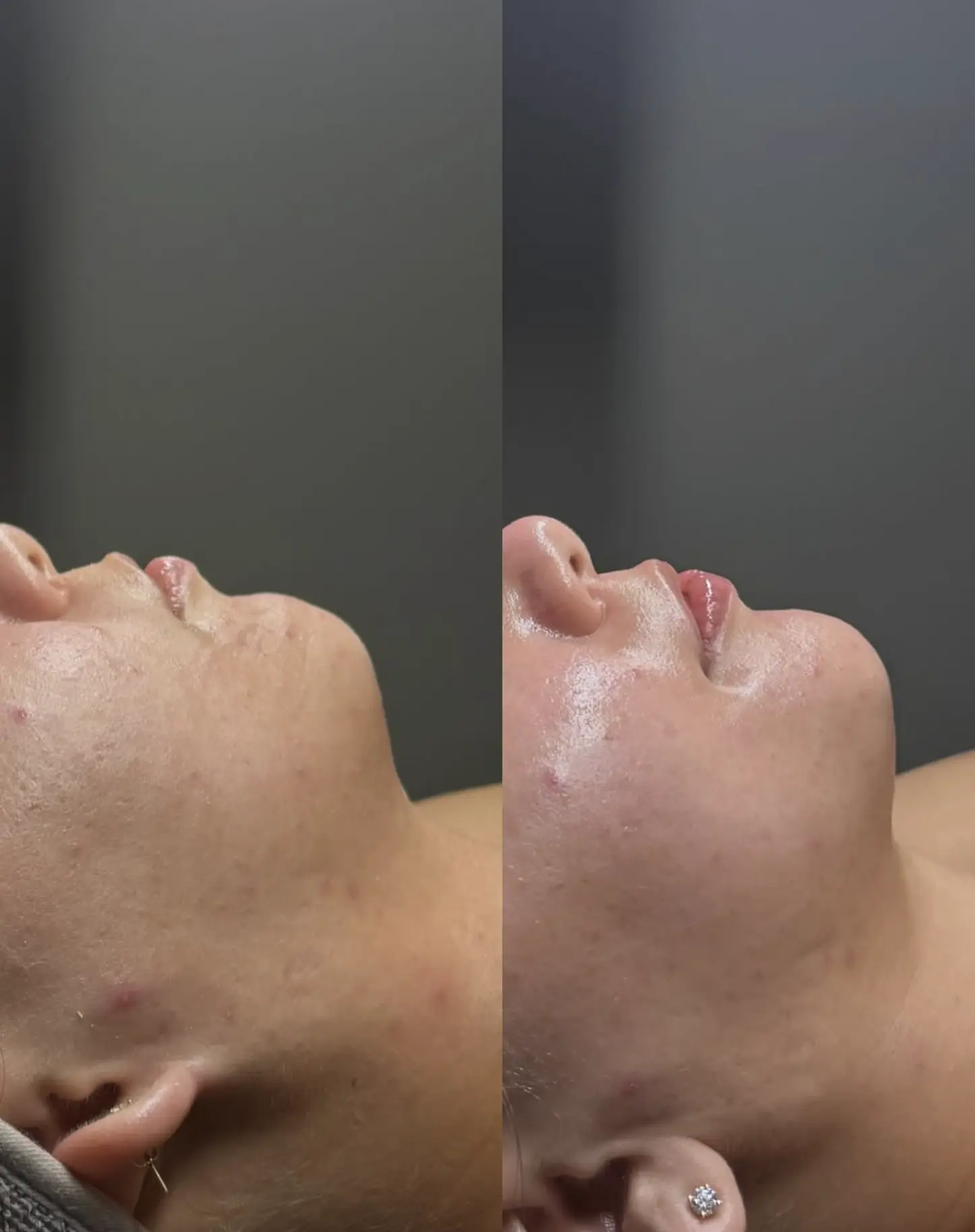 The Facial Hub facial studio